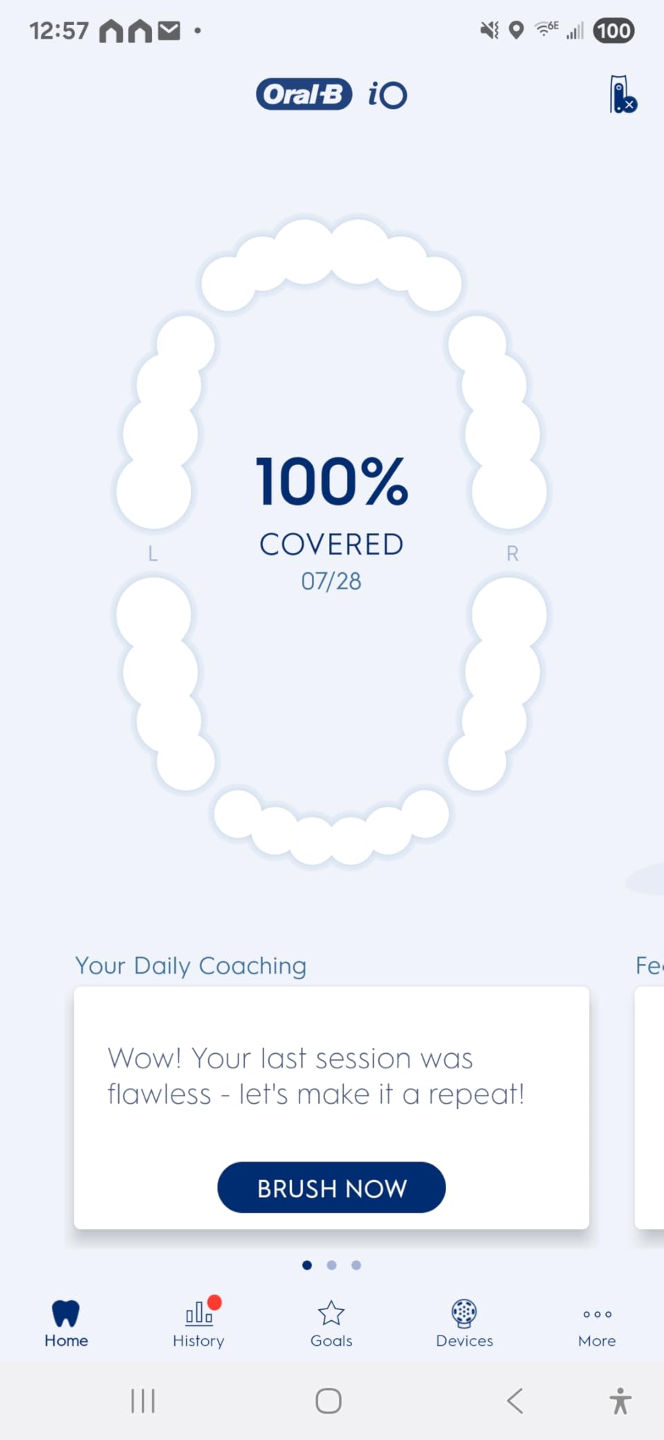 Oral-B iO Deep Clean + Whiten Rechargeable Electric Toothbrush with Visible Pressure Sensor, 2 Minute Timer, 5 Cleaning Settings, 1 iO5 Limited, 3 Toothbrush Heads, Travel Case & Refill Holder, Black customer photo 1