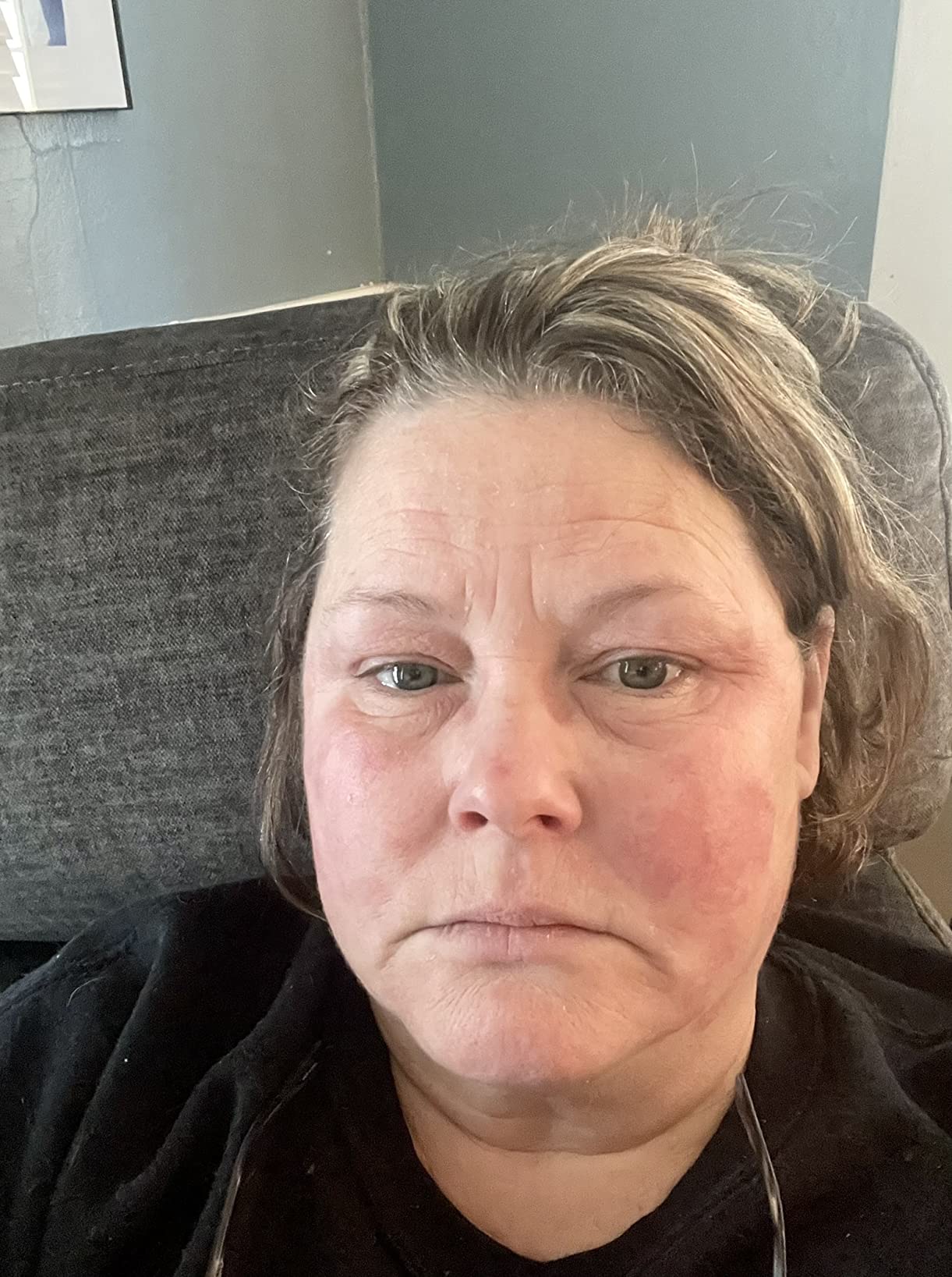 Paula's Choice CLINICAL 1% Retinol Face Treatment with Peptides, Vitamin C & Licorice Extract, Anti-Aging Skin Care Serum, Fine Lines & Wrinkles, Fragrance Free customer photo 1