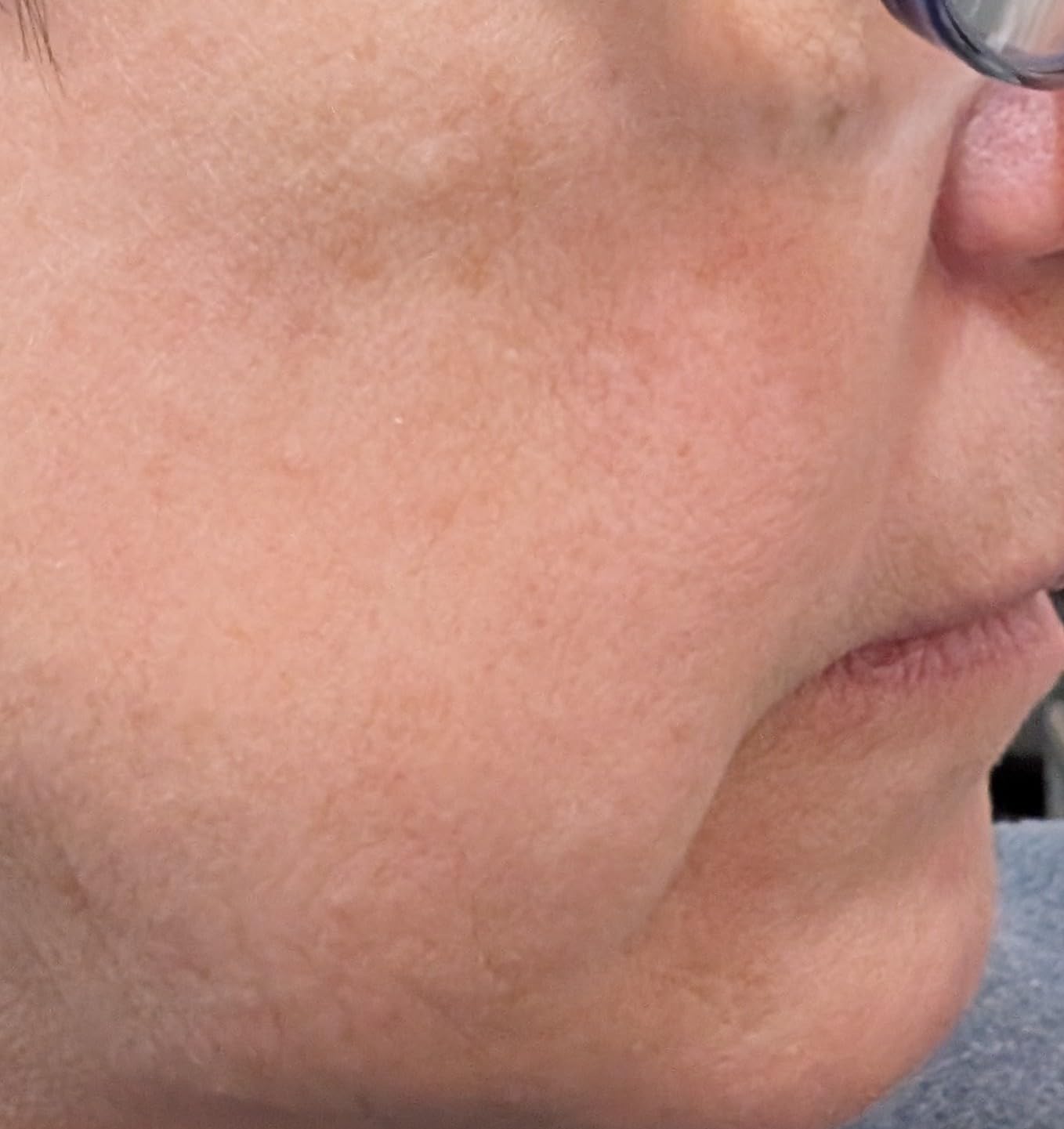 CeraVe Skin Renewing Night Cream, Niacinamide, Peptide Complex, and Hyaluronic Acid Moisturizer for Face, 1.7 Ounce, Packaging may Vary customer photo 1