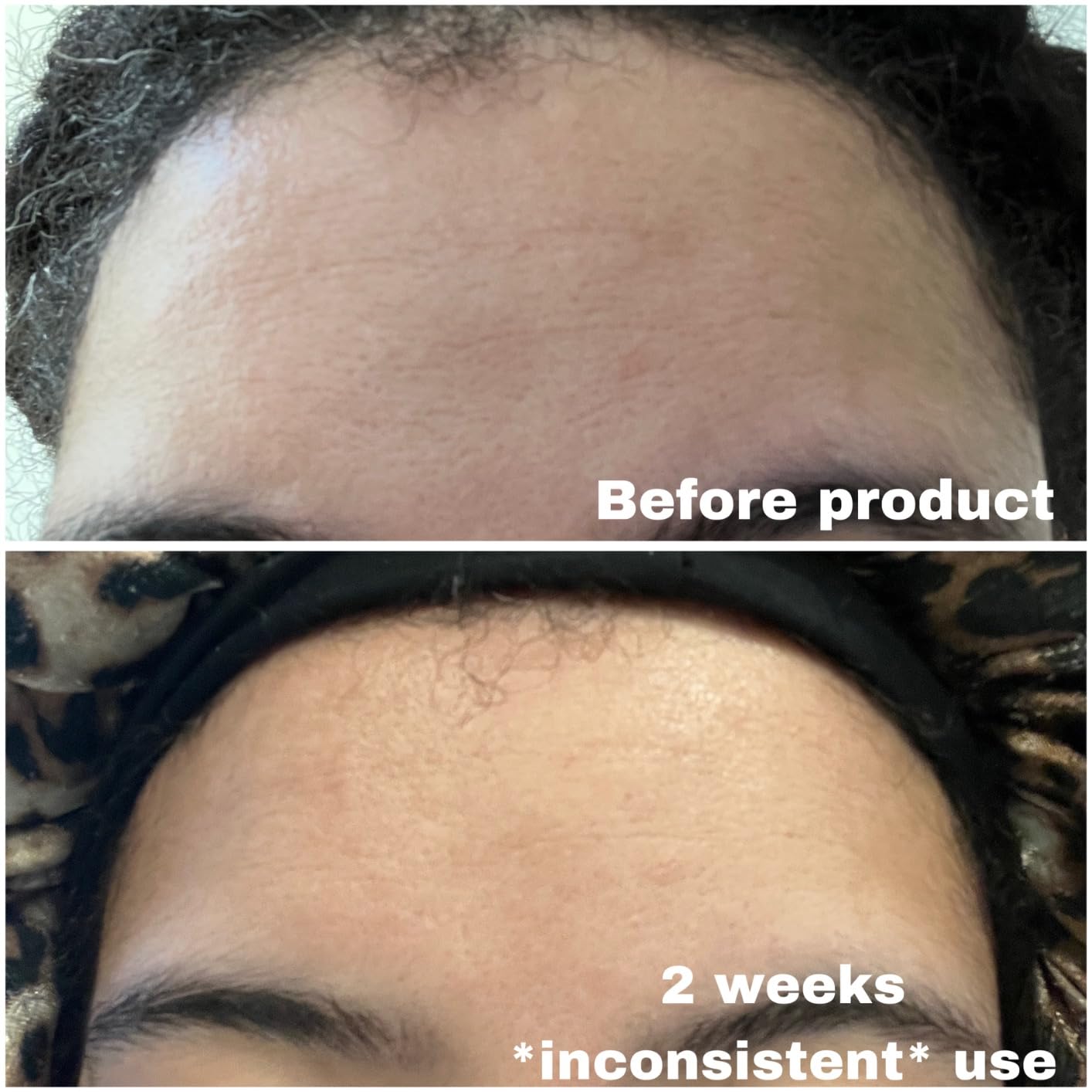 Neutrogena Rapid Wrinkle Repair Retinol Face Moisturizer, Daily Anti-Aging Face Cream with Retinol & Hyaluronic Acid to Fight Fine Lines, Wrinkles, & Dark Spots, 1.7 oz customer photo 2