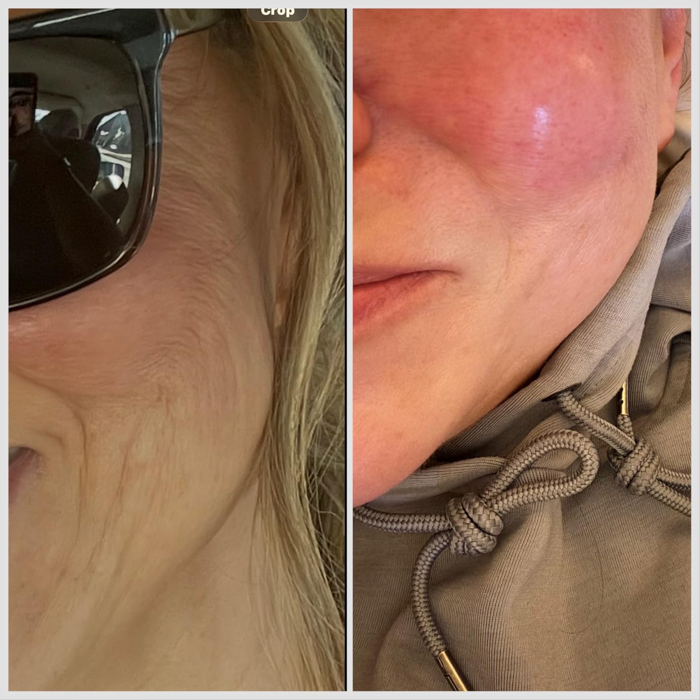 RoC Retinol Correxion Max Daily Hydration Anti-Aging Face Moisturizer with Hyaluronic Acid, Oil Free Skin Care Cream for Fine Lines, Dark Spots, Post-Acne Scars, Retinol Moisturizer, 1.7 Ounces customer photo 2