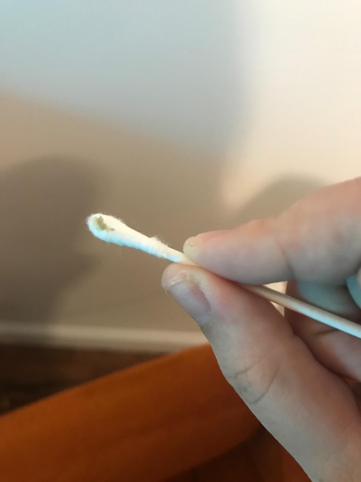 VOYOR Blackhead Remover Pore Vacuum - Electric Face Vacuum Pore Cleaner Acne White Heads Removal with 6 Suction Heads (BR410) customer photo 2