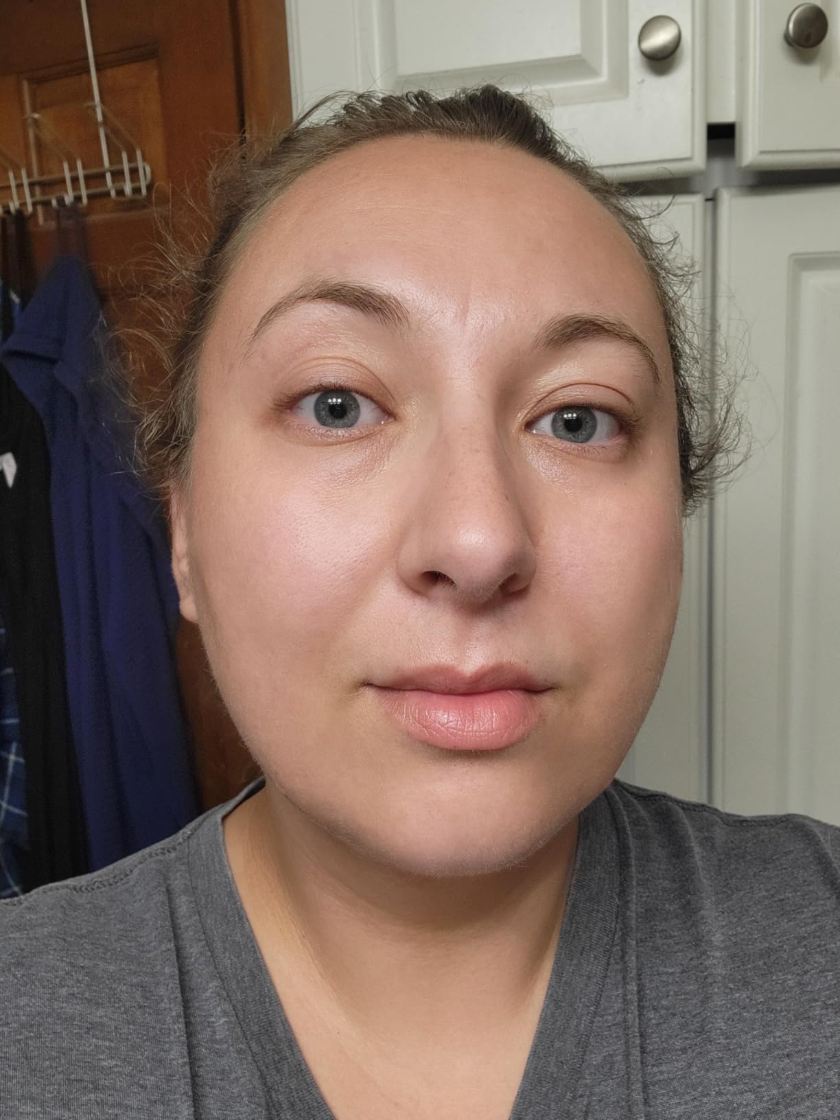 The Ordinary Retinol 1% in Squalane, High-Strength Retinol Serum for Anti-Aging and Skin Smoothing customer photo 2