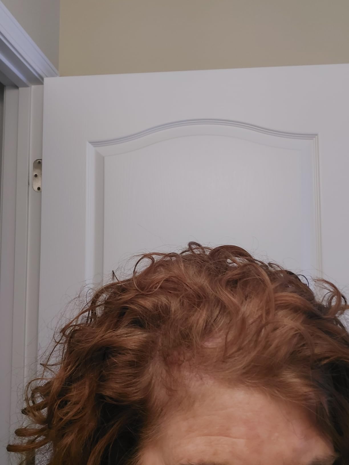 Nutrafol Women's Balance Hair Growth Supplements, Ages 45 and Up, Clinically Proven for Visibly Thicker Hair and Scalp Coverage, Dermatologist Recommended - 1 Month Supply customer photo 2