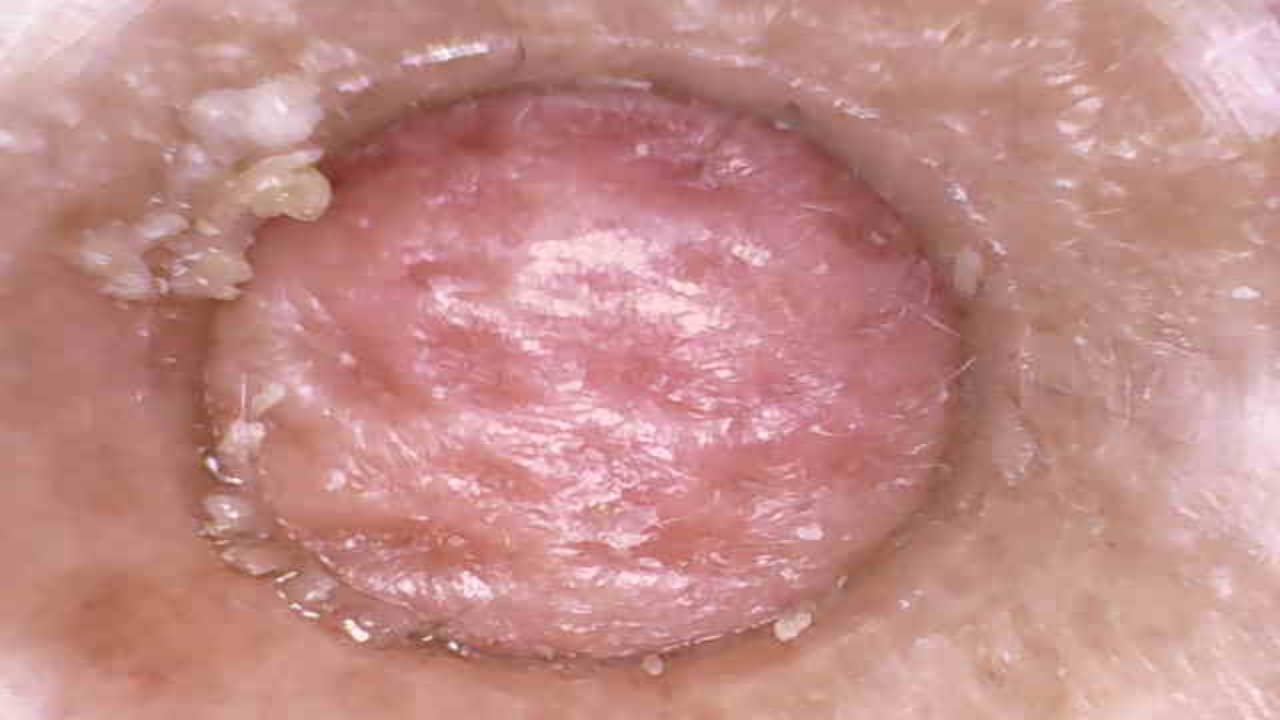 Blackhead Remover Pore Vacuum with 5MP HD Camera, 20X Magnification WiFi Visible Facial Pore Cleanser, FDA-Registered Electric Pimple Acne Comedone Extractor Kit for Men & Women with 6 Probes customer photo 2