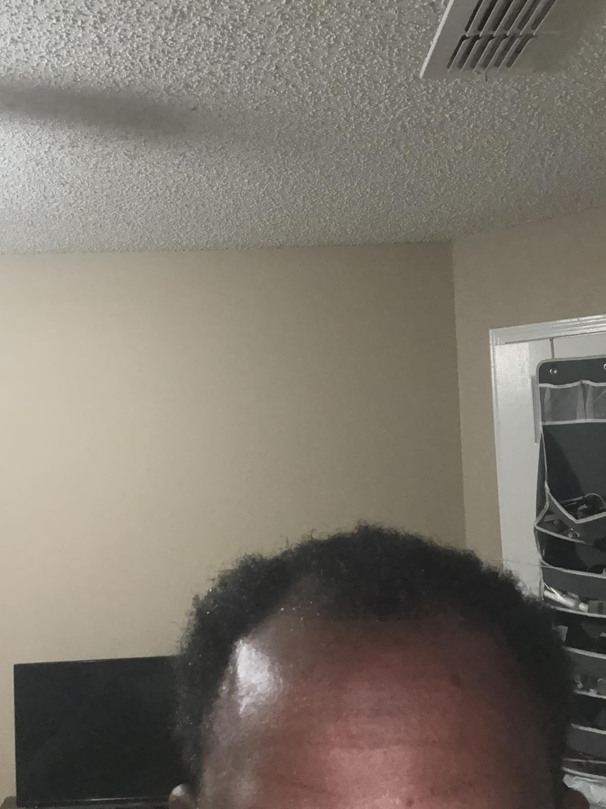 Koi Beauty Derma Roller Titanium Microneedle Roller, 540 Microneedling Roller for Men Women Face Scalp customer photo 1