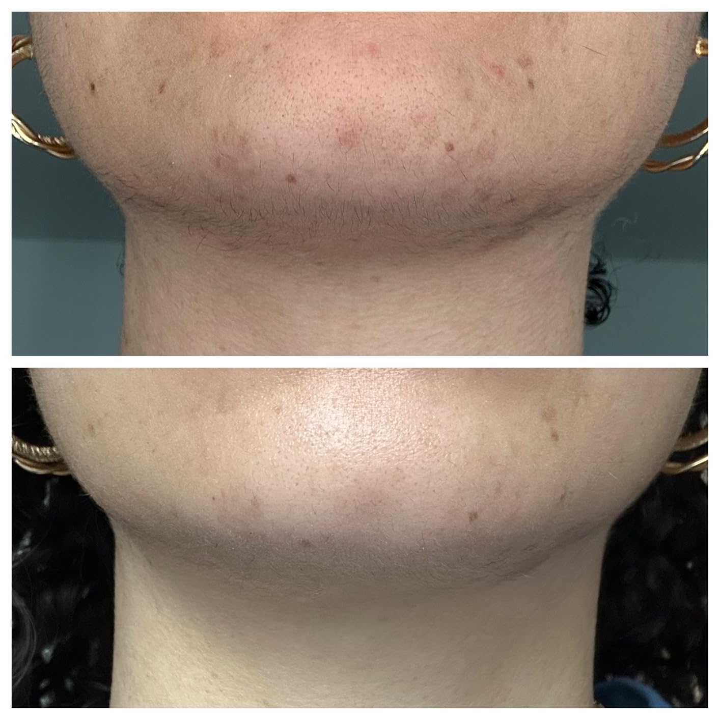 Cetaphil Vitamin C Serum, Visibly Reduces Look of Dark Spots and Hyperpigmentation, Formulated with Niacinamide, Designed for Sensitive Skin, Fragrance Free, Dermatologist Tested, 1oz customer photo 1