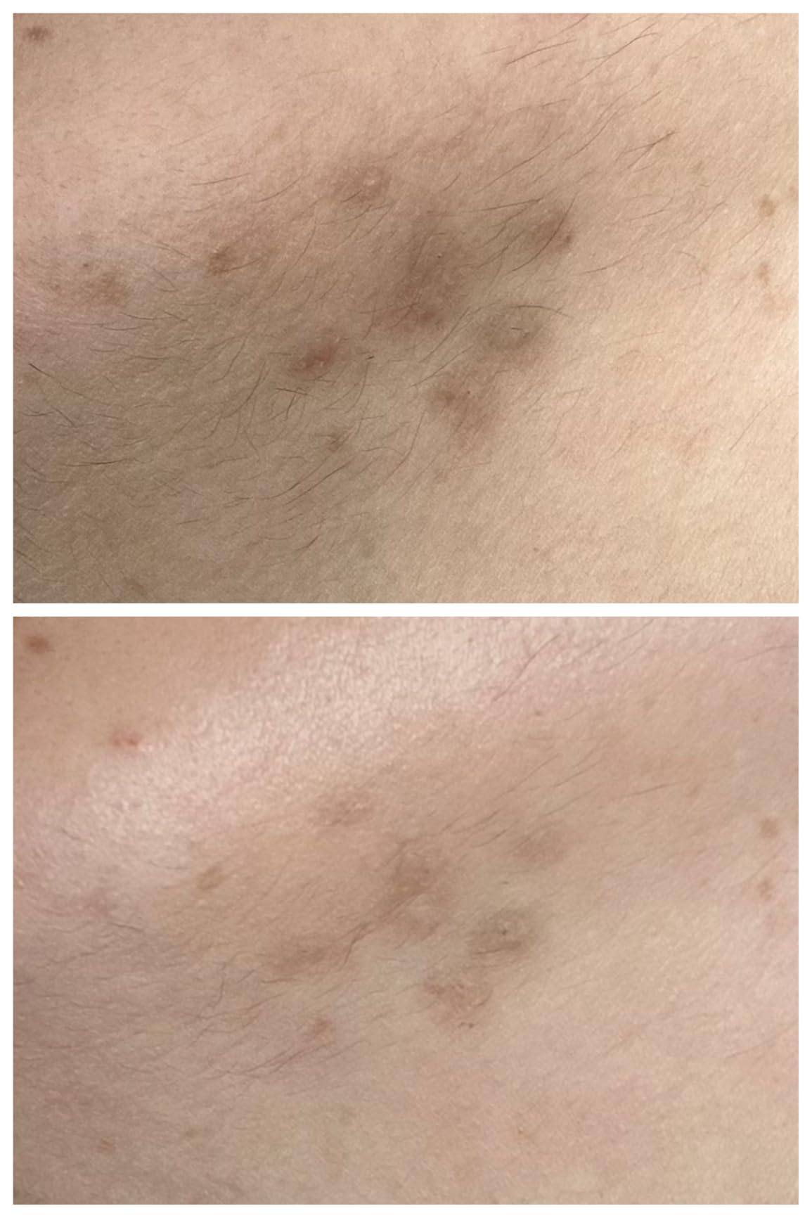 Cetaphil Vitamin C Serum, Visibly Reduces Look of Dark Spots and Hyperpigmentation, Formulated with Niacinamide, Designed for Sensitive Skin, Fragrance Free, Dermatologist Tested, 1oz customer photo 2