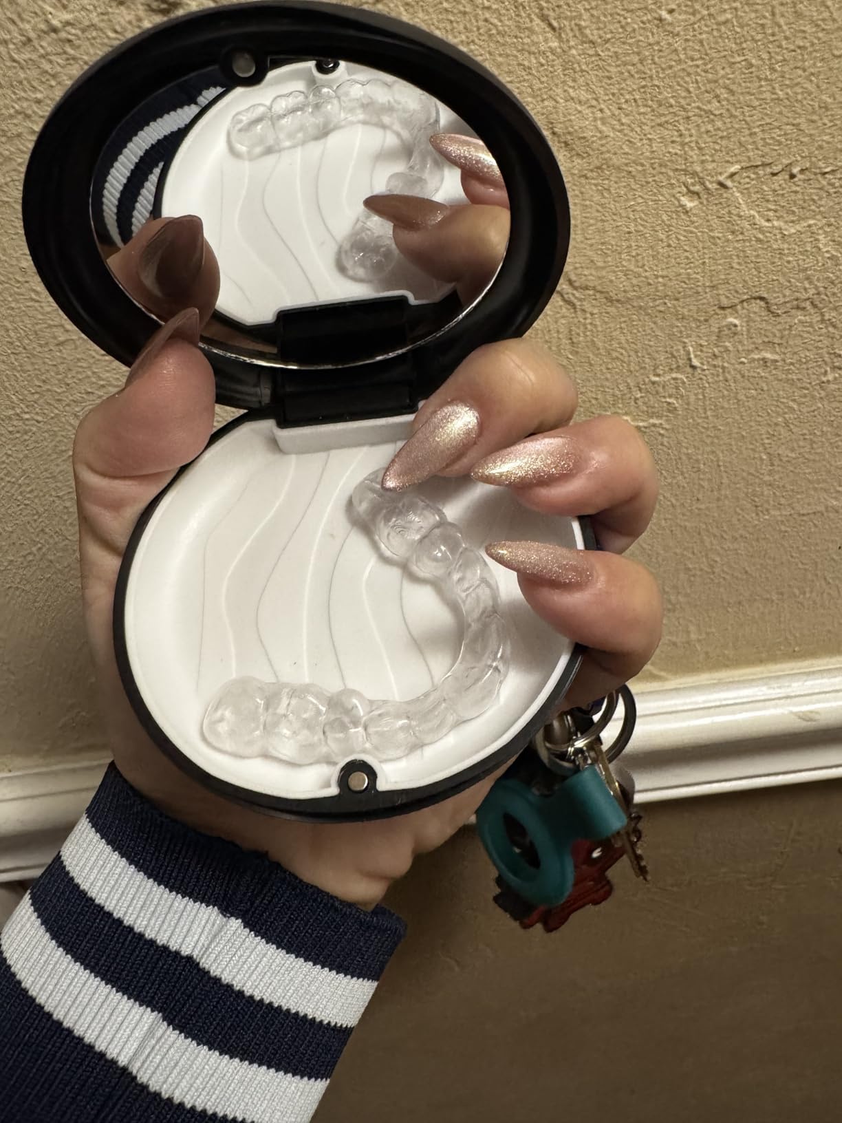 Custom Night Guard, Custom Mouth Teeth Guards Against Teeth Grinding/Clenching Dental Retainer for TMJ Relief and Bruxism (One Upper Guard) customer photo 1