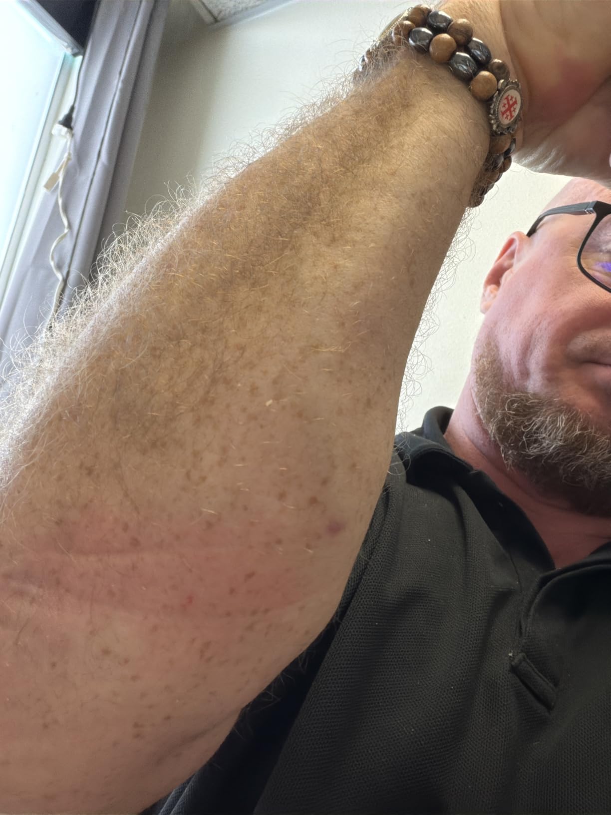 FitBeast Forearm Strengthener & Forearm Exerciser, Wrist Roller with Thicker Handle, Forearm Strength Trainer with Adjustable Strap - Ideal for Grip Strength, Muscle Building, Rehabilitation customer photo 1