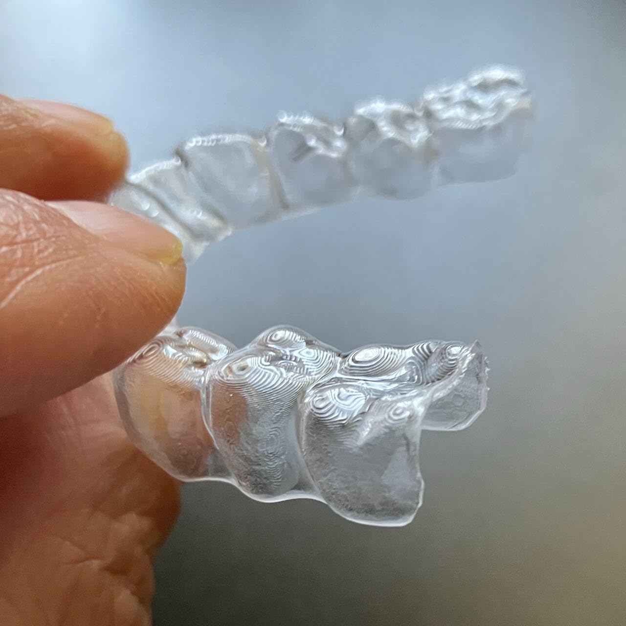 Custom Night Guard, Clear Retainers for Teeth, Bite Night Guard for Adults & Kids, Mouth Guards for Grinding/TMJ/Bruxism/Teeth Clenching Nighttime customer photo 1