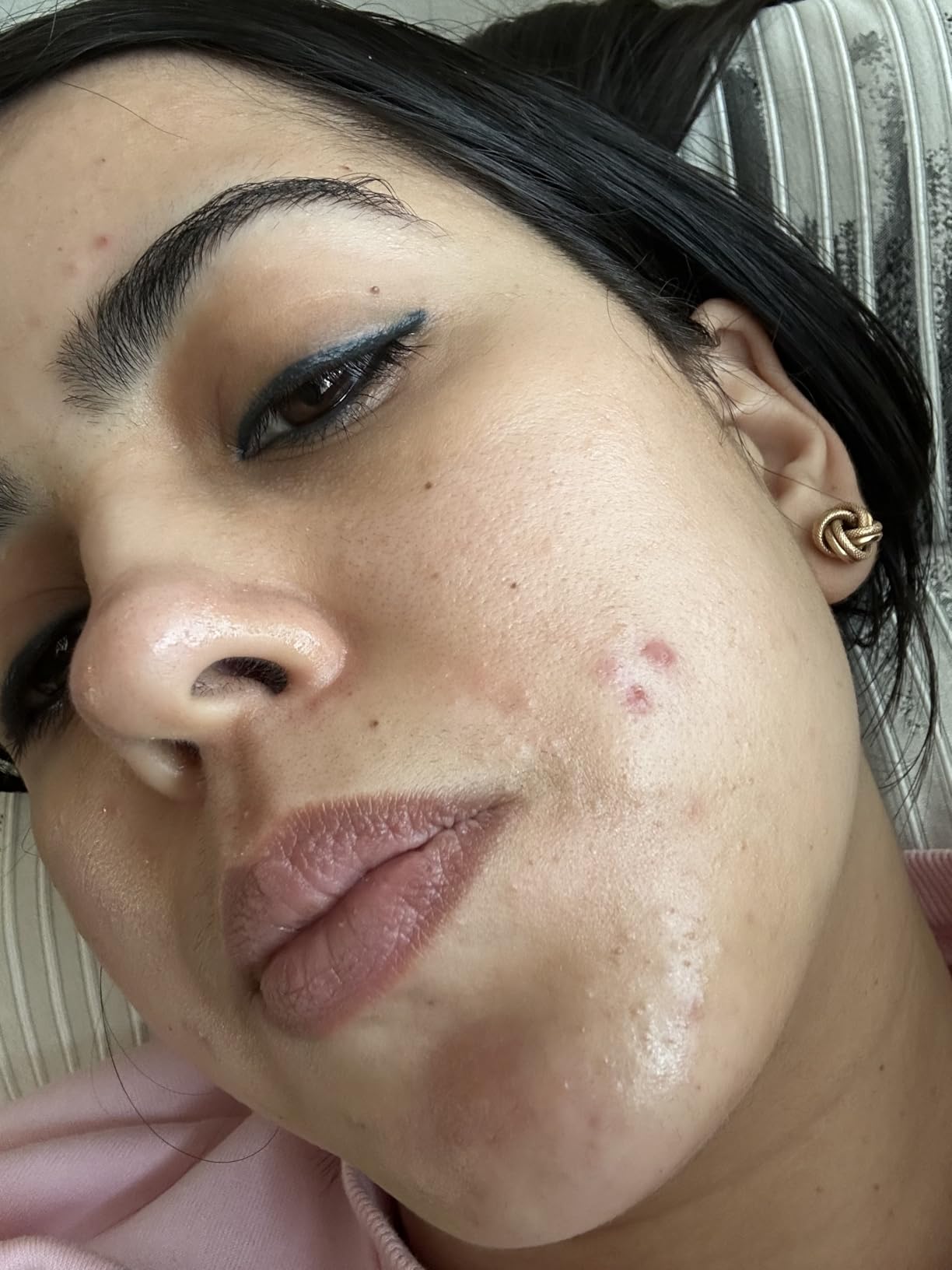 La Roche-Posay Pure 12% Vitamin C Serum For Face With Hyaluronic Acid & Salicylic Acid, Hydrating Face Serum, Boost Radiance & Reduce Wrinkles, 2 Formulas for Normal or Oily Skin Control customer photo 2