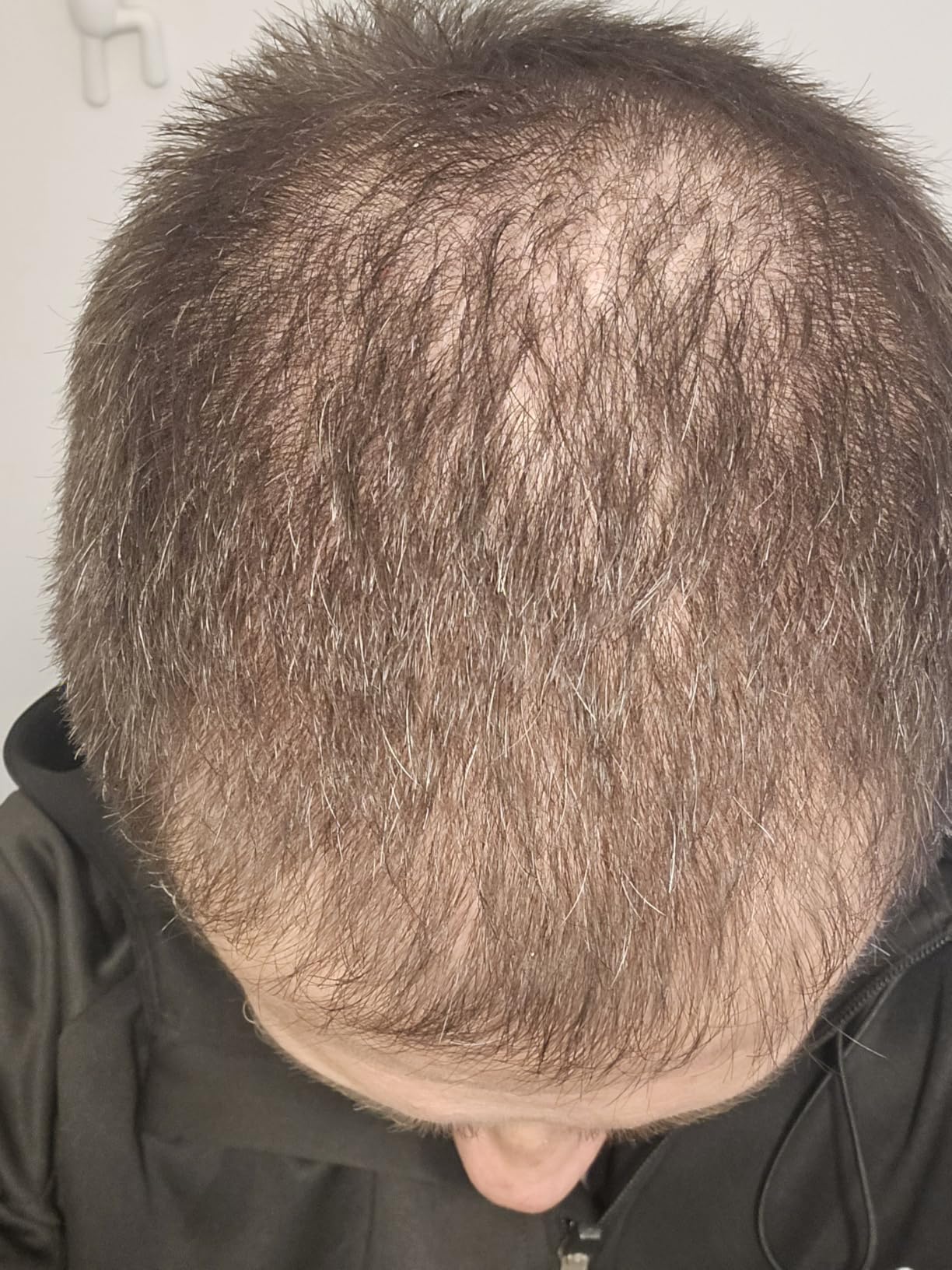 Happy Head Hair Growth Supplement for Men and Women - Thicker, Fuller Hair with Saw Palmetto, Ashwagandha, Biotin, Collagen, Keratin, Probiotics & Vitamins A & D - One Month Supply - 60/ct customer photo 1