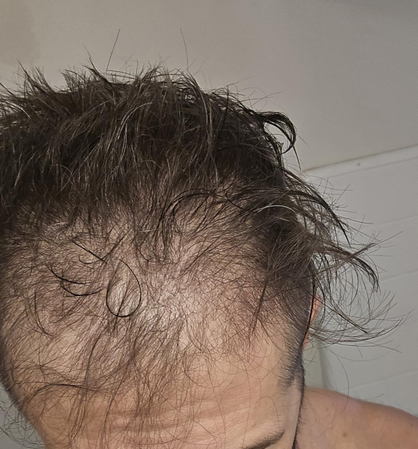 Happy Head Hair Growth Supplement for Men and Women - Thicker, Fuller Hair with Saw Palmetto, Ashwagandha, Biotin, Collagen, Keratin, Probiotics & Vitamins A & D - One Month Supply - 60/ct customer photo 2