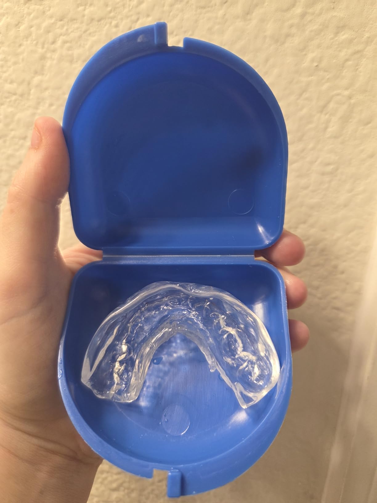 Moldable Mouth Guard for Teeth Grinding, Customizable Boil-and-Bite Mouthguard for Clenching, Dental Protection for Adults, Teens and Kids customer photo 1