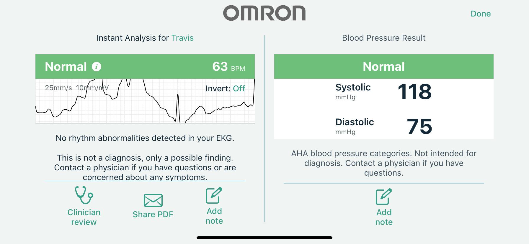 OMRON Complete 2-in-1 Blood Pressure Monitor + EKG for Home Use | Upper Arm Blood Pressure Cuff - #1 Doctor & Pharmacist Recommended Brand - Clinically Validated - Connect App customer photo 1