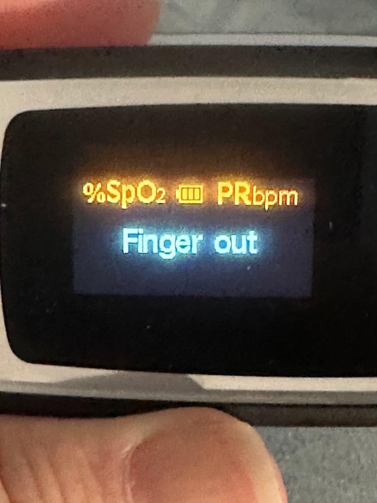 Innovo Deluxe iP900AP Fingertip Pulse Oximeter Blood Oxygen Saturation Monitor with Alarm, Plethysmograph and Perfusion Index customer photo 2