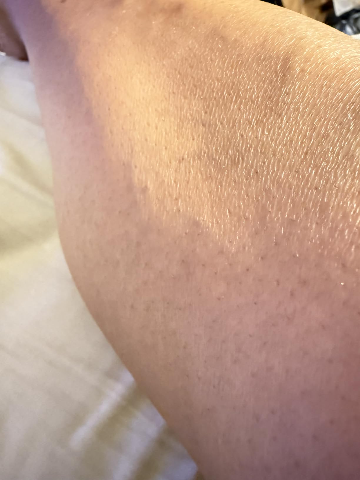 Braun Silk-épil 9 Epilator, Pivoting Head, Wet and Dry, Includes Body Trimmer, Shaver Head and Trimmer Comb, SES9-441 customer photo 2