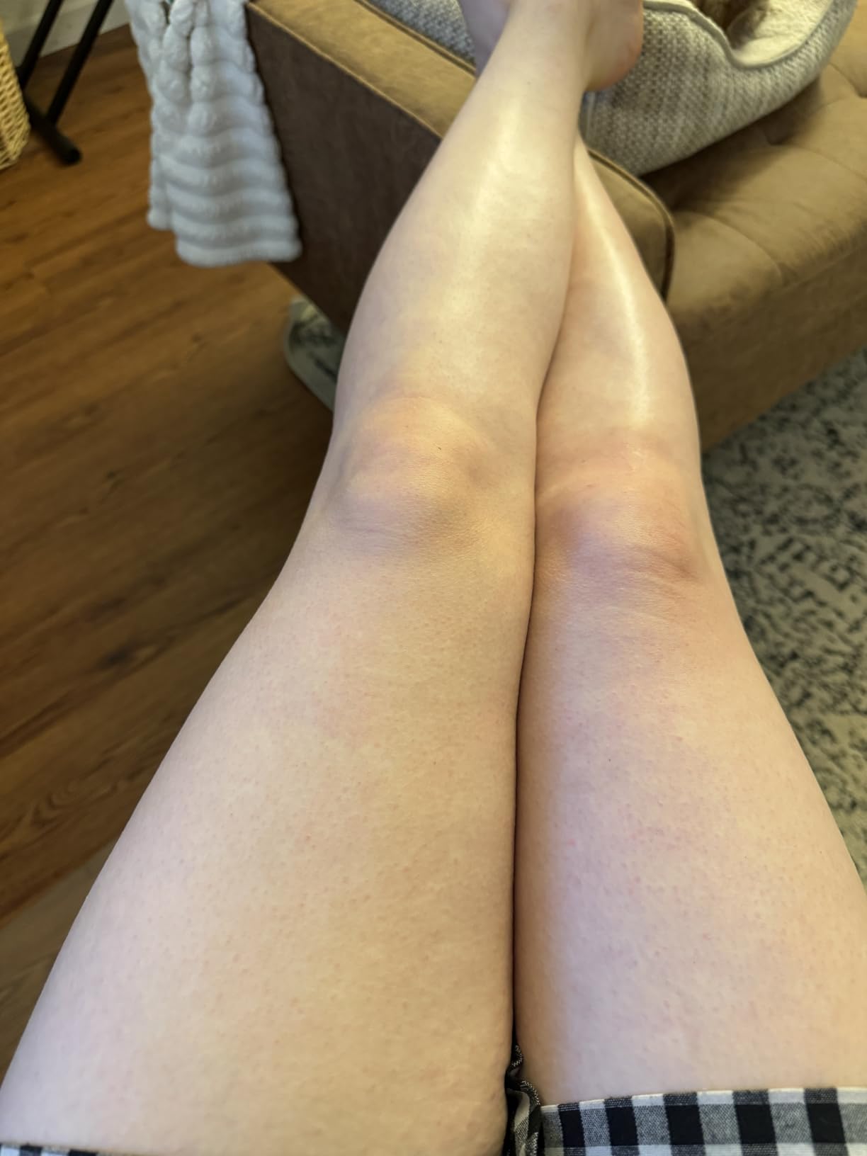 Philips Epilator Series 2000, Corded Epilator for Legs and Body, Hair Removal Device for Women, Model BRE227/00 customer photo 1