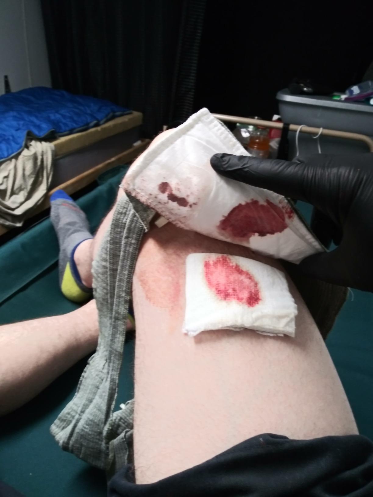 Lightning X Gunshot Trauma/Hemorrhage Control Kit in MOLLE IFAK Pouch - TAN customer photo 2