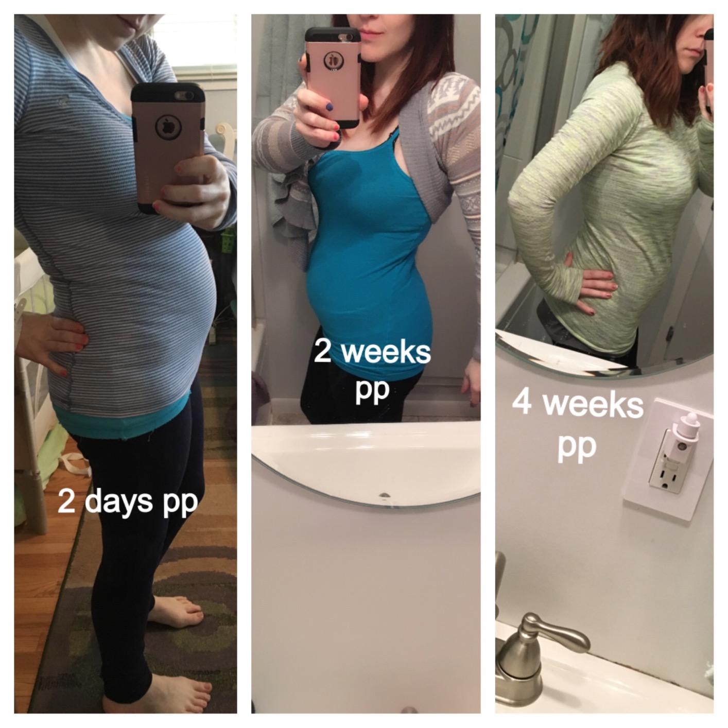 Postpartum Belly Band Support: 2 Adjustable Straps for Abdomen Compression customer photo 2