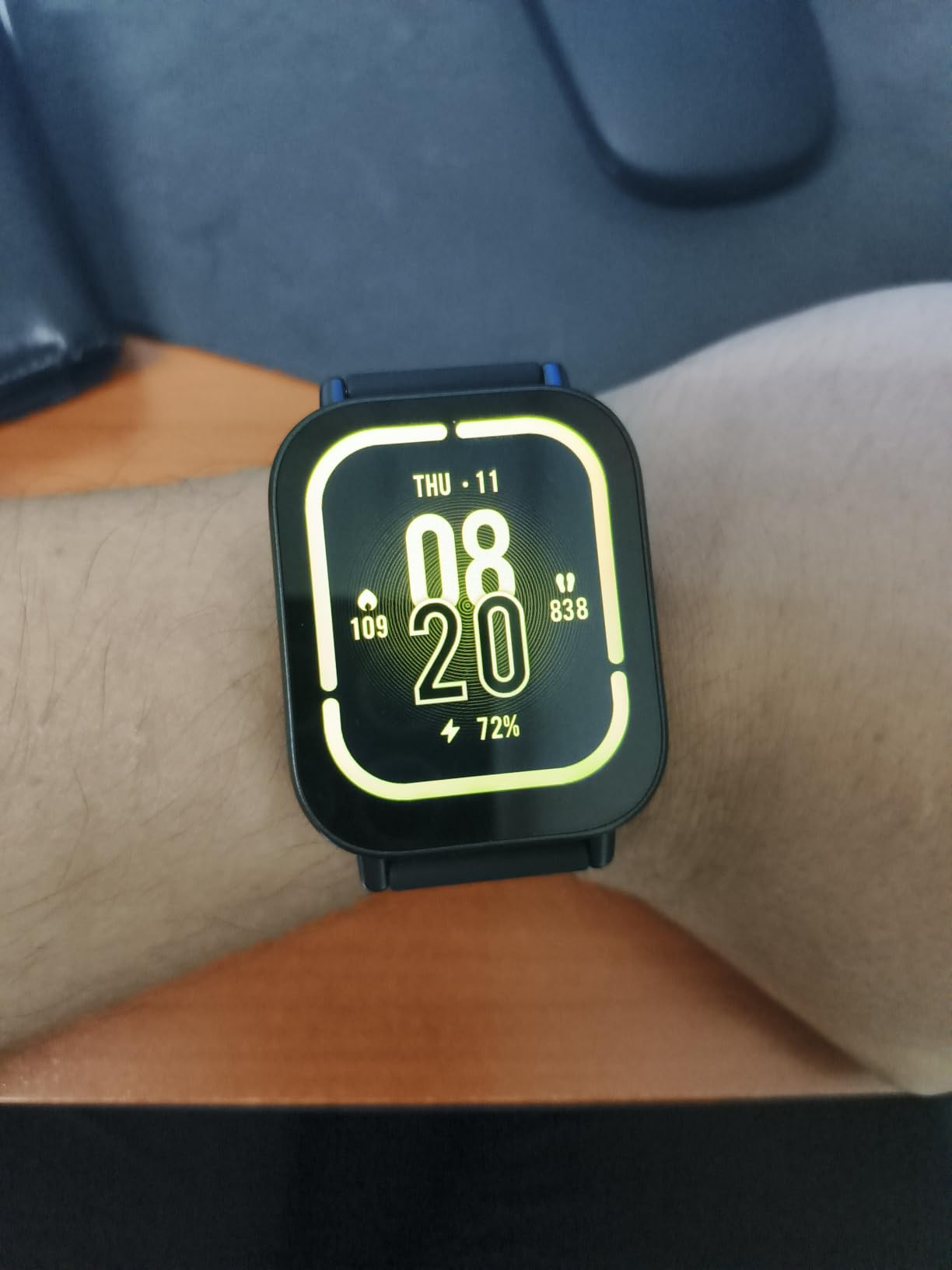 XIAOMI Redmi Watch 5 Active Midnight Black customer photo 1