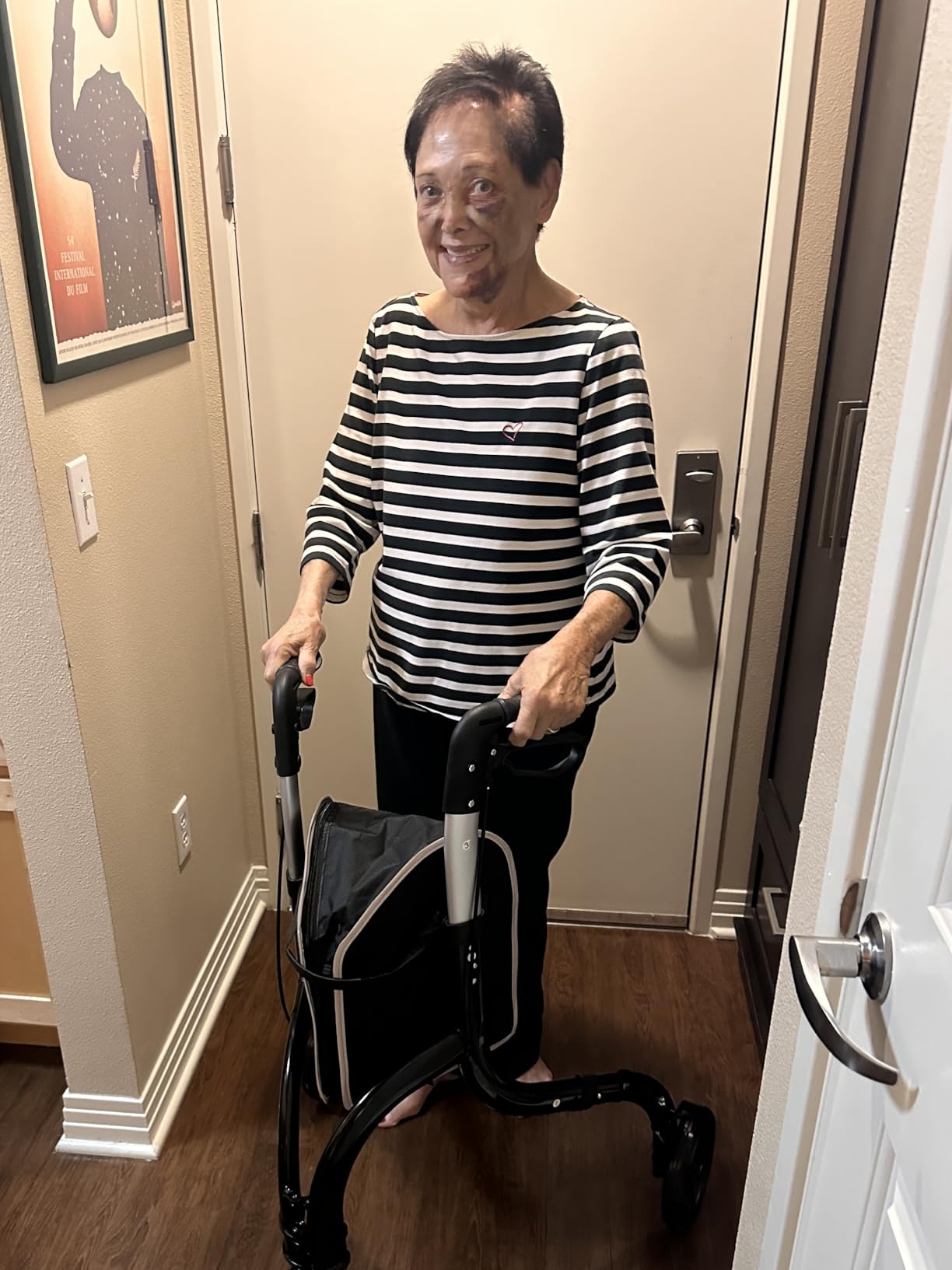 soundfuse Lightweight 3 Wheel Walkers for Seniors, Foldable Aluminum Frame customer photo 1